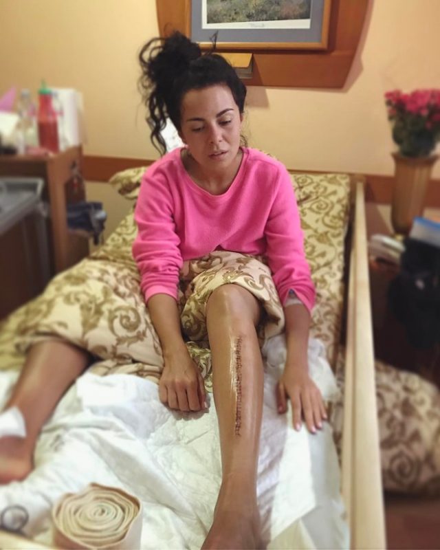 Настя Каменских опубликовала фото после операции Настя Каменских опубликовала фото после операции