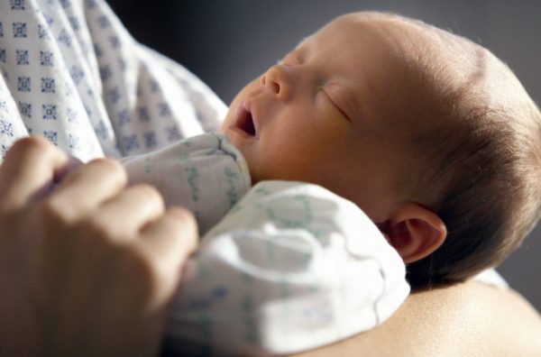 Желтушка у новорожденных: причины, симптомы и лечение