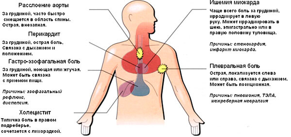 Причины боли в области грудной клетки 
