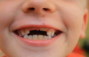 Как режутся зубки у детей последовательность