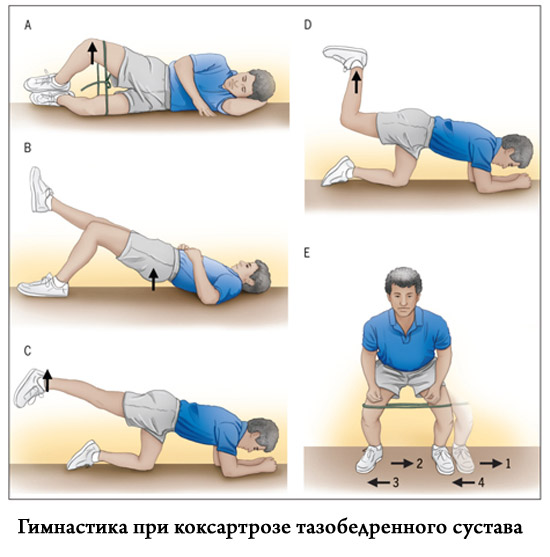 Лечебные упражнения