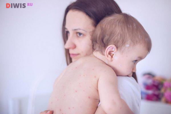 Терапия типичных и нетипичных проявлений болезни