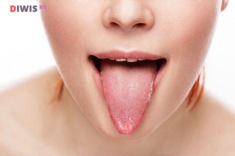 Ожог языка: первая помощь и лечение