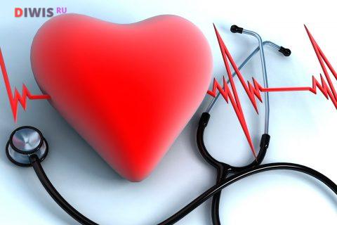 Аритмия сердца - причины, симптомы и лечение