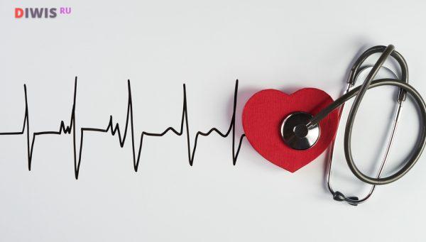 Все что важно знать о мерцательной аритмии сердца