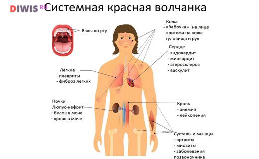 Код по МКБ 10