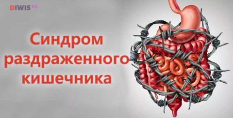 Лечение синдрома раздраженного кишечника