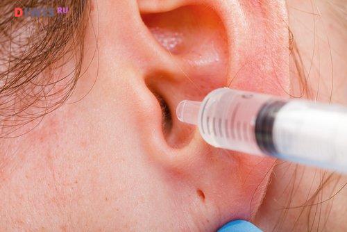 Причины появления и методы лечения зуда в ушах