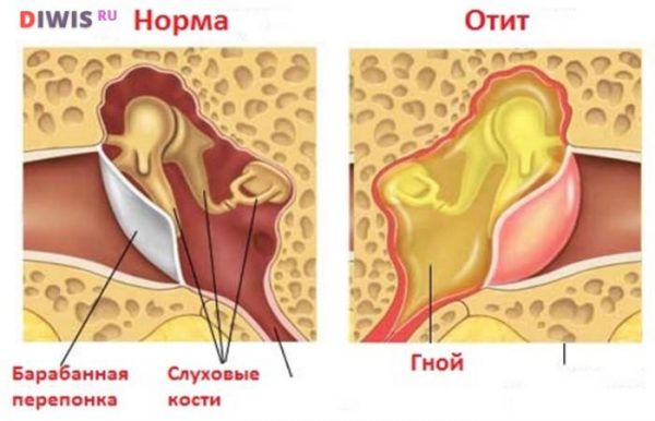 Причины появления и методы лечения зуда в ушах