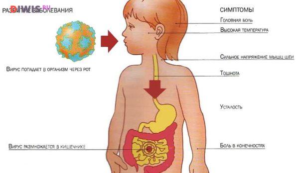 Симптомы и лечение ротавирусной инфекции у грудничка