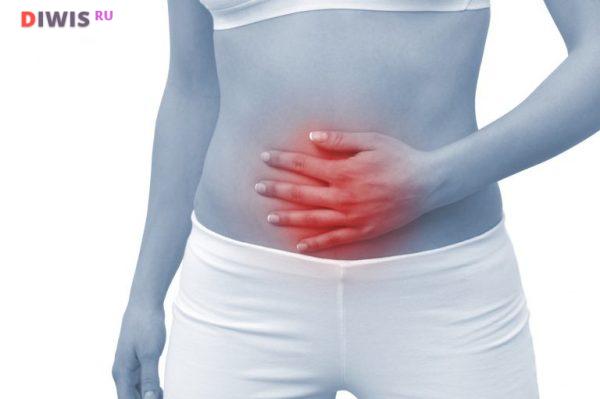 Симптомы и лечение дисбактериоза кишечника у женщин